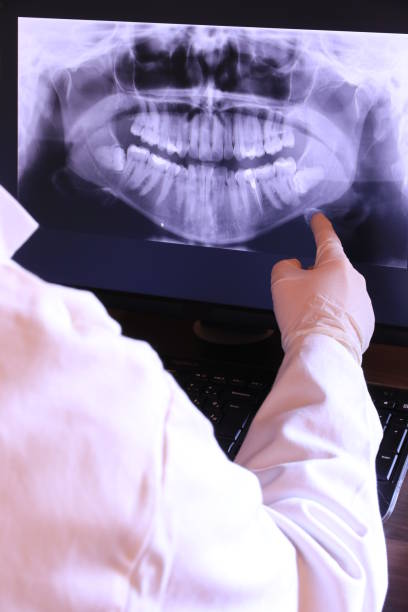 Best Emergency Root Canal Treatment in Lauderdale Lakes, WI